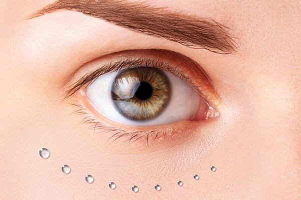 preenchimento de olheiras em araçatuba