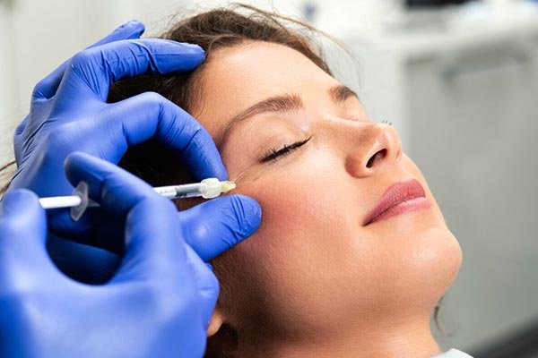 preenchimento das olheiras com ácido hialurônico específico para a região infraorbital