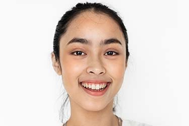 procedimento para corrigir bigode chinês