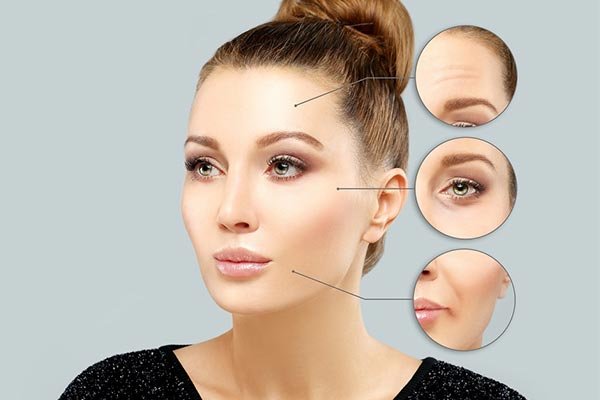 botox full face em todo o rosto